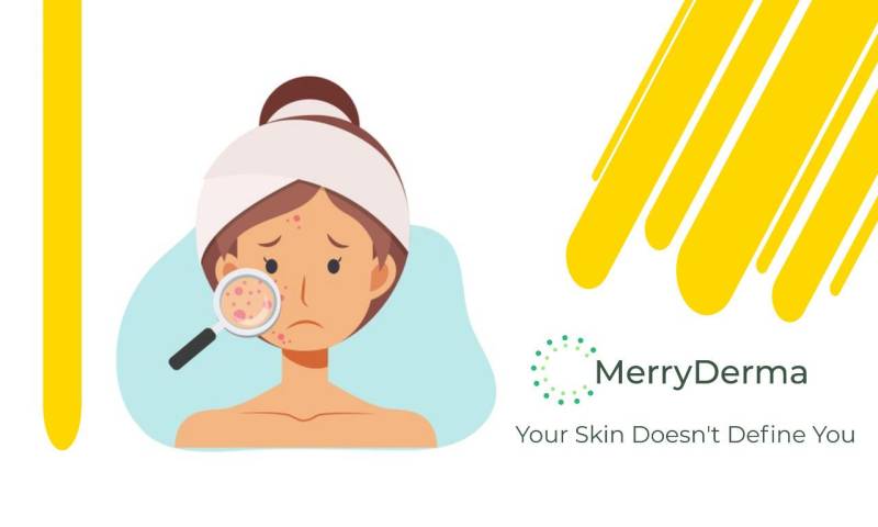 Normalizing Skin Issues - No Such Thing As ‘Bad’ Skin - MerryDerma