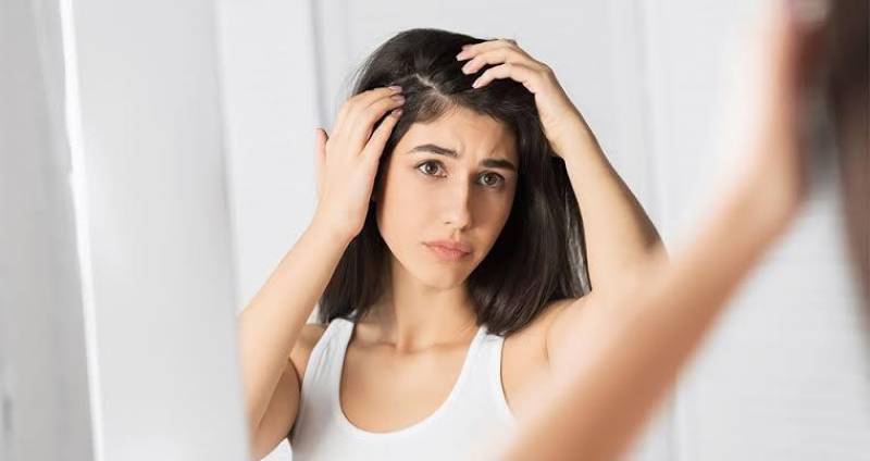 5 WAYS TO DEAL WITH AN OIL SCALP 
