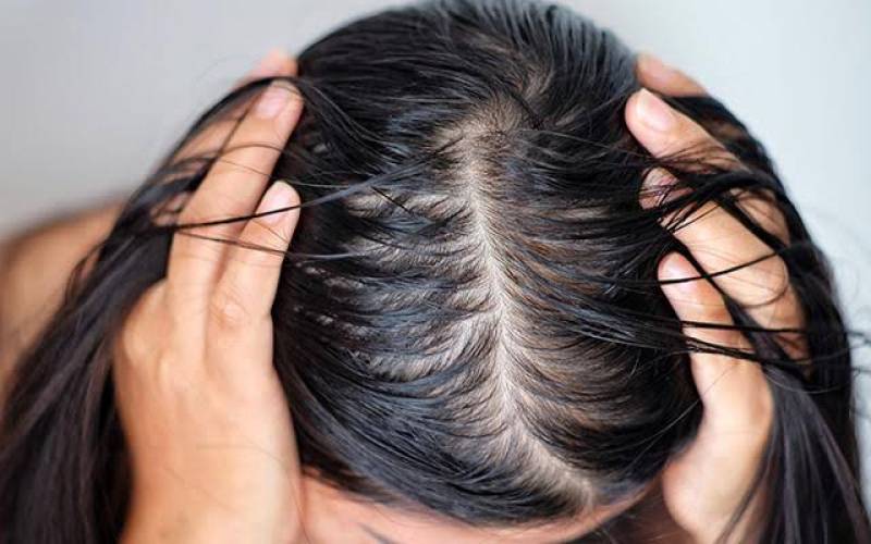 OILY HAIR REMEDY: 5 TIPS TO GET RID OF GREASY HAIR 